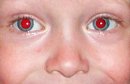 Как избежать «красных» глаз на фотографиях?